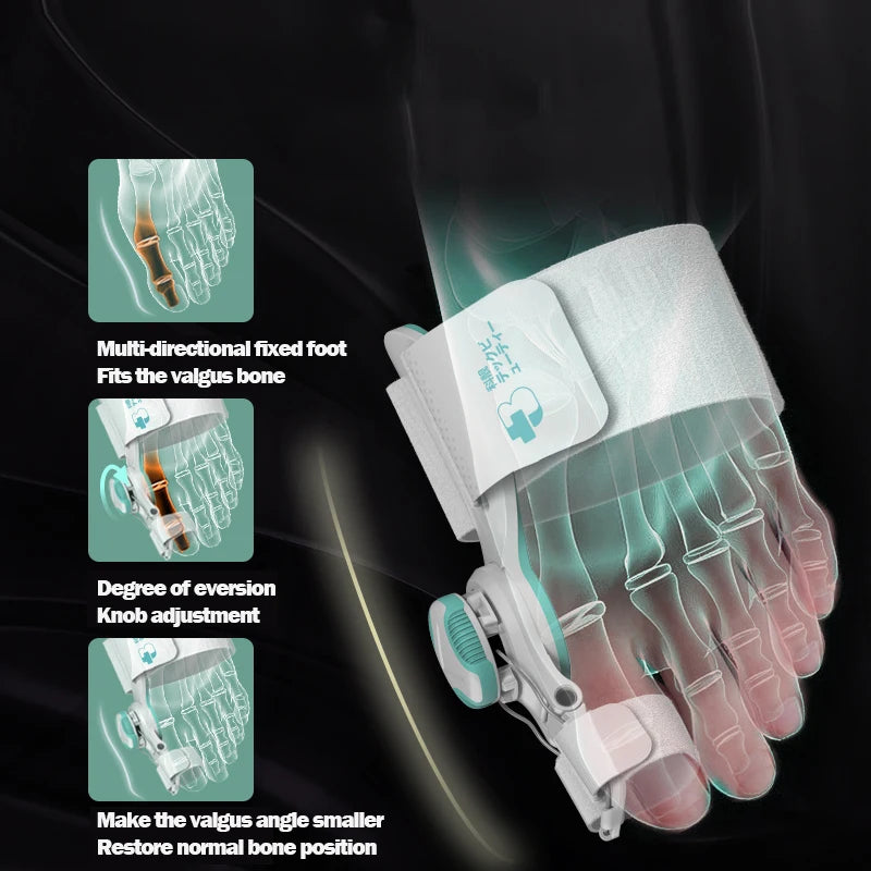 Hallux Valgus Correction Bunion Splint – All-Day Pain Relief & Toe Alignment Support